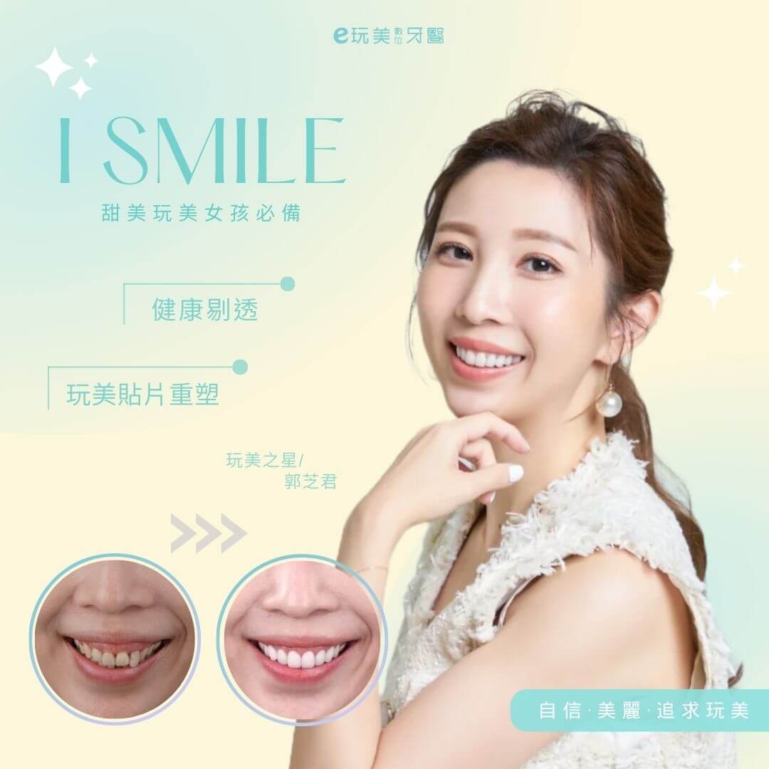 質感好好的牙齒～我很滿意！