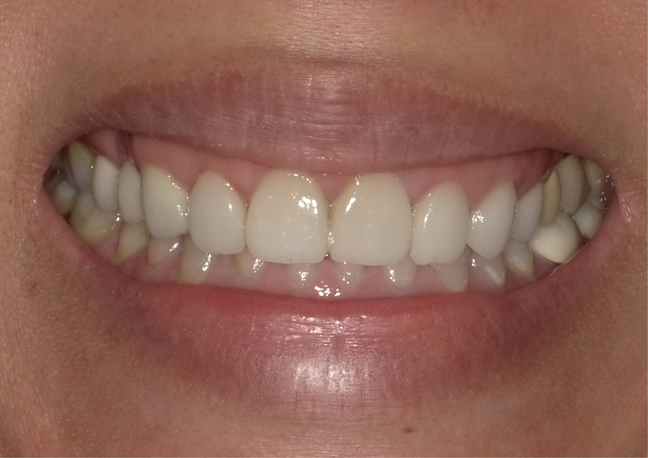 不用遮掩的魅力自信～陽光的GIRL'S POWER/玫林