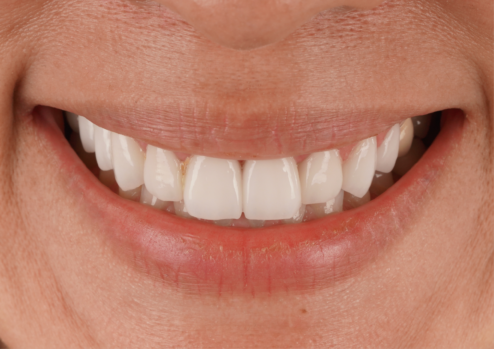 不用遮掩的魅力自信～陽光的GIRL'S POWER/玫林