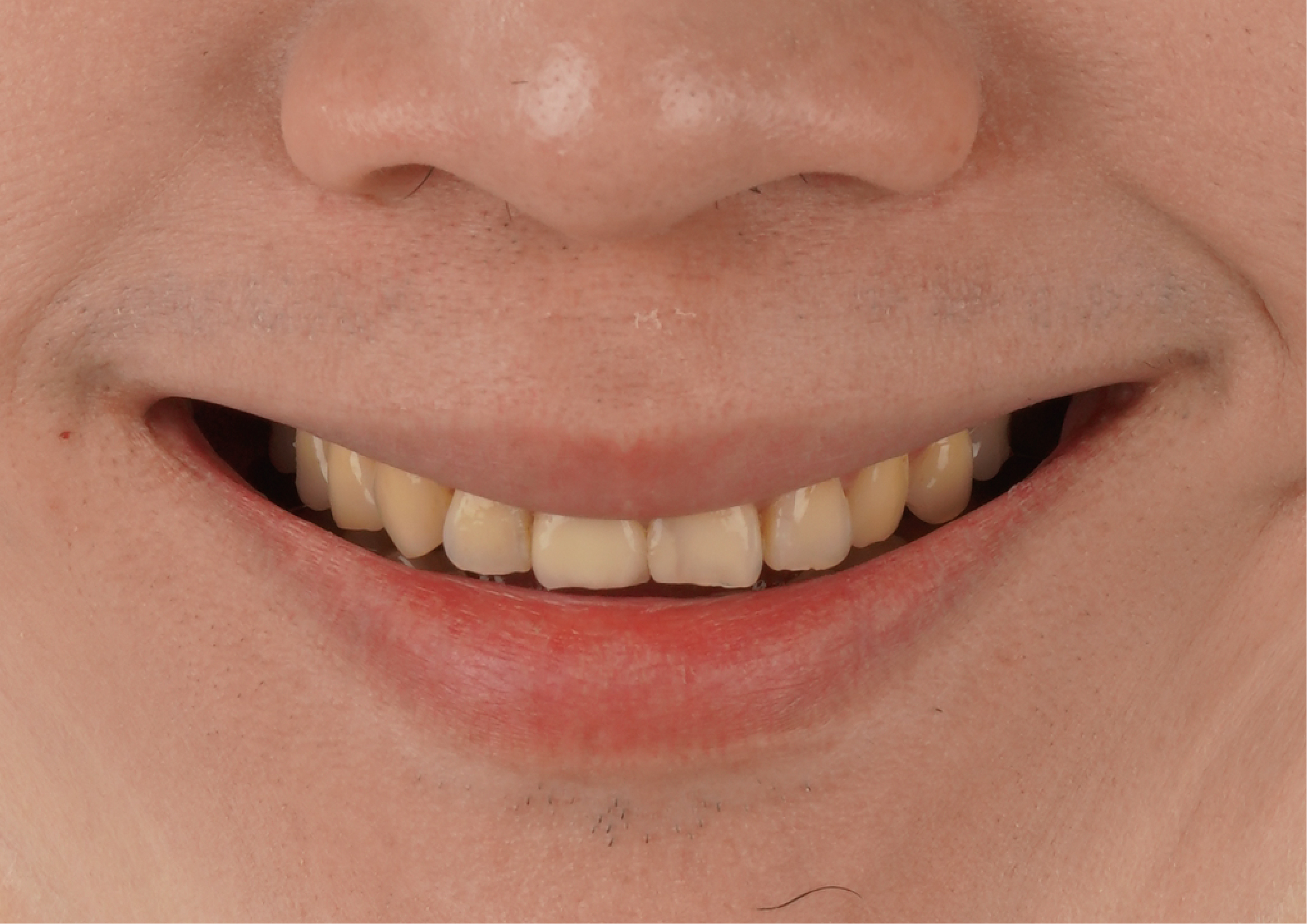 YouTuber米鹿：投資健康笑容～找玩美就對了！