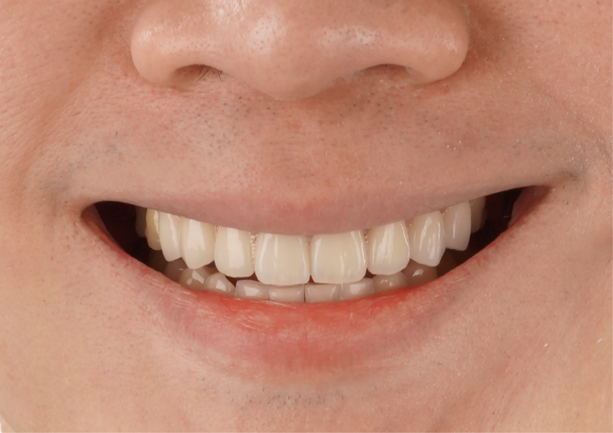 YouTuber米鹿：投資健康笑容～找玩美就對了！