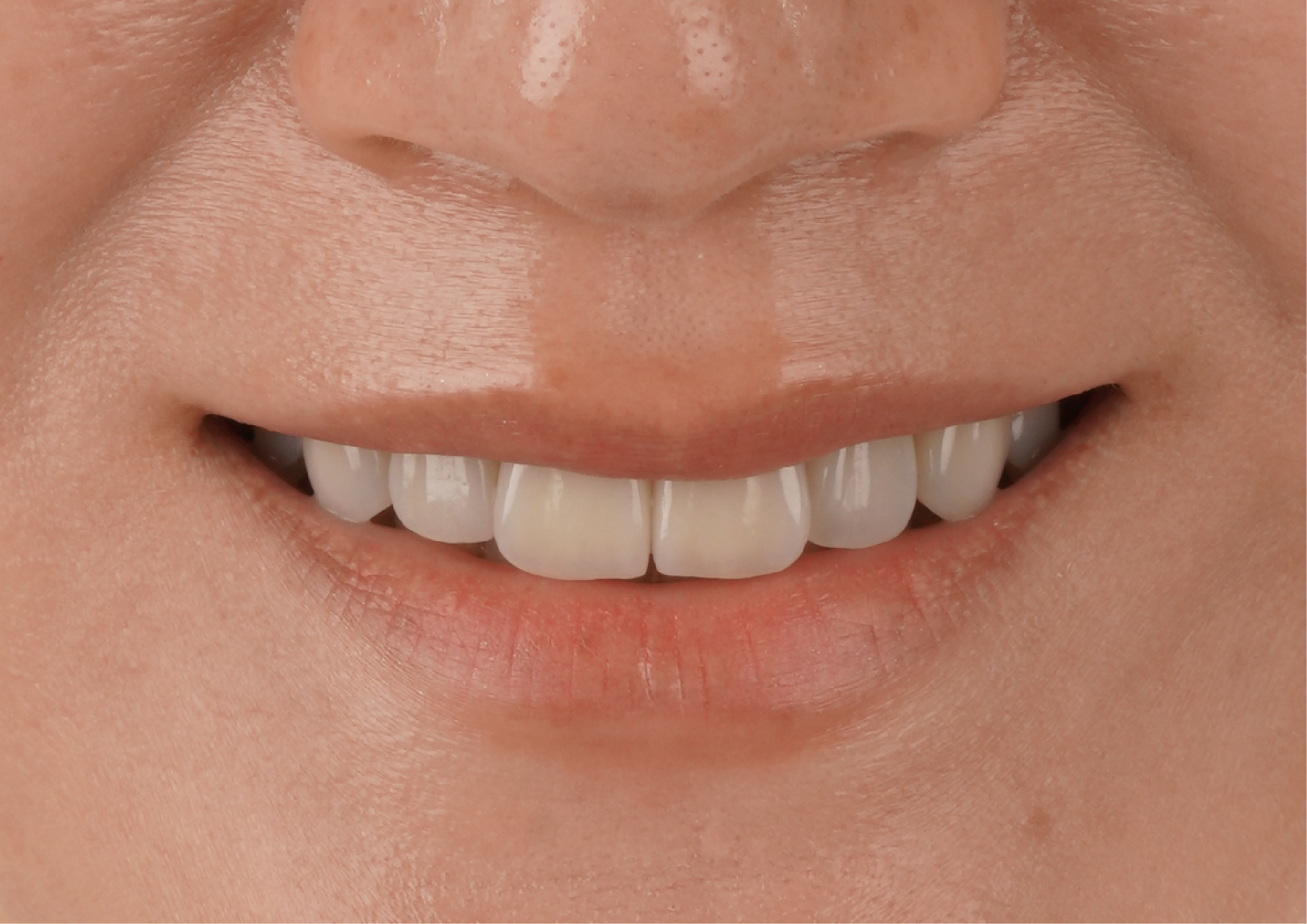 過期空姐~美麗永保新鮮的玩美密方！