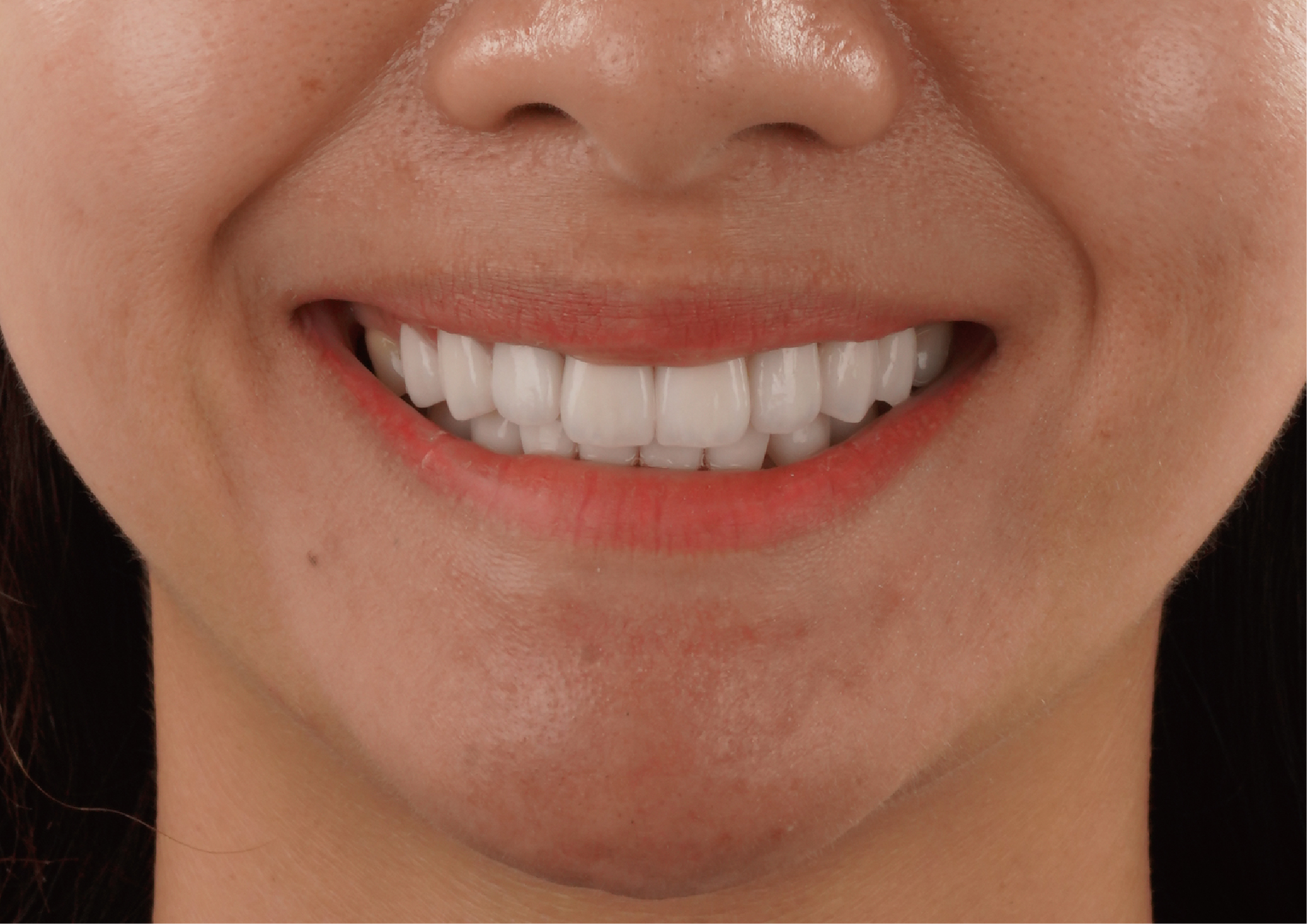 笑容添自信～讓你各種角色都玩美！