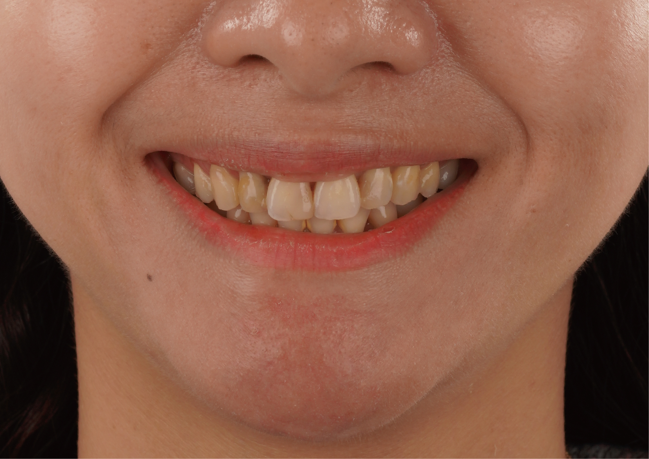 笑容添自信～讓你各種角色都玩美！