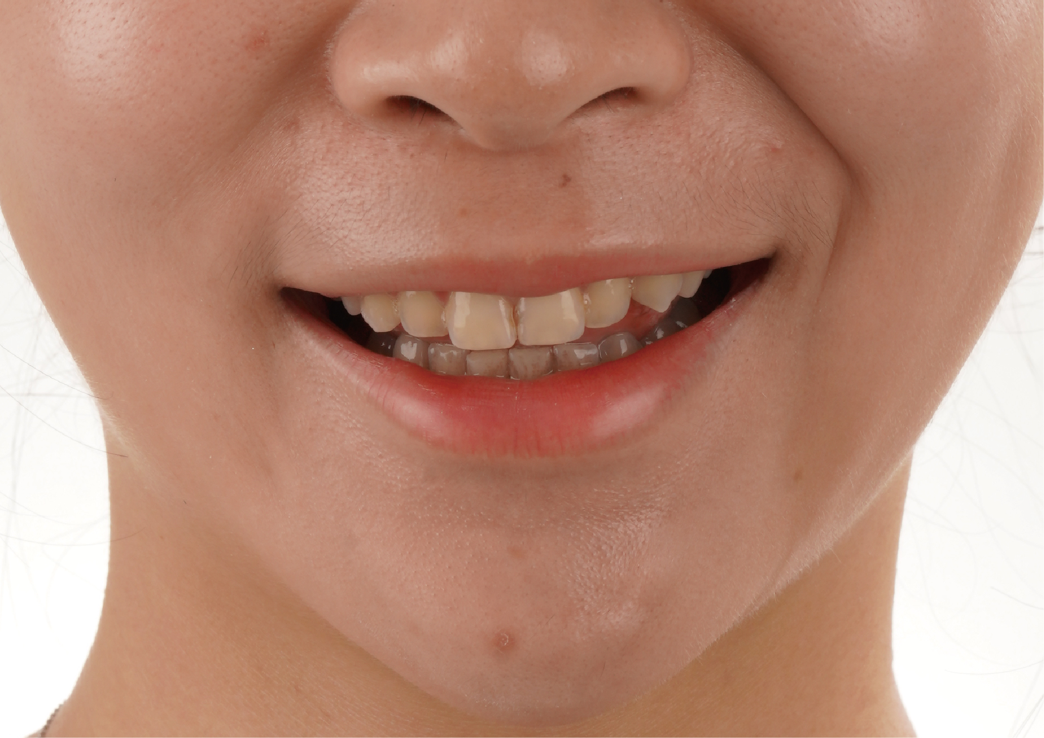 KIMI用玩美笑容～紀錄最自信的人生態度～