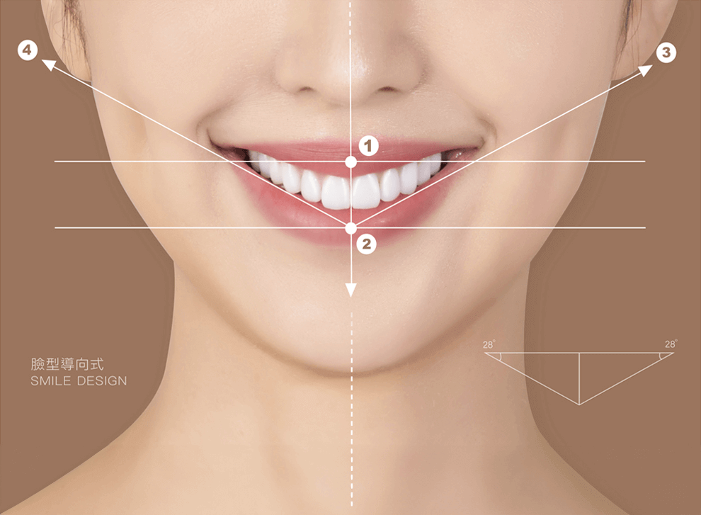 V-Line Smile Design