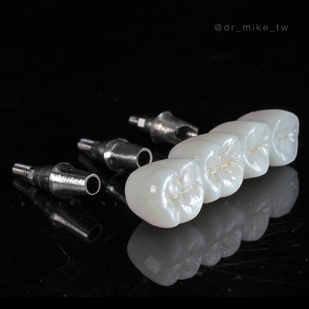 植牙選玩美！根本解決問題～安全/專業/舒適 新境界～