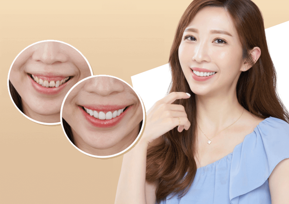 這就是我要的微笑曲線