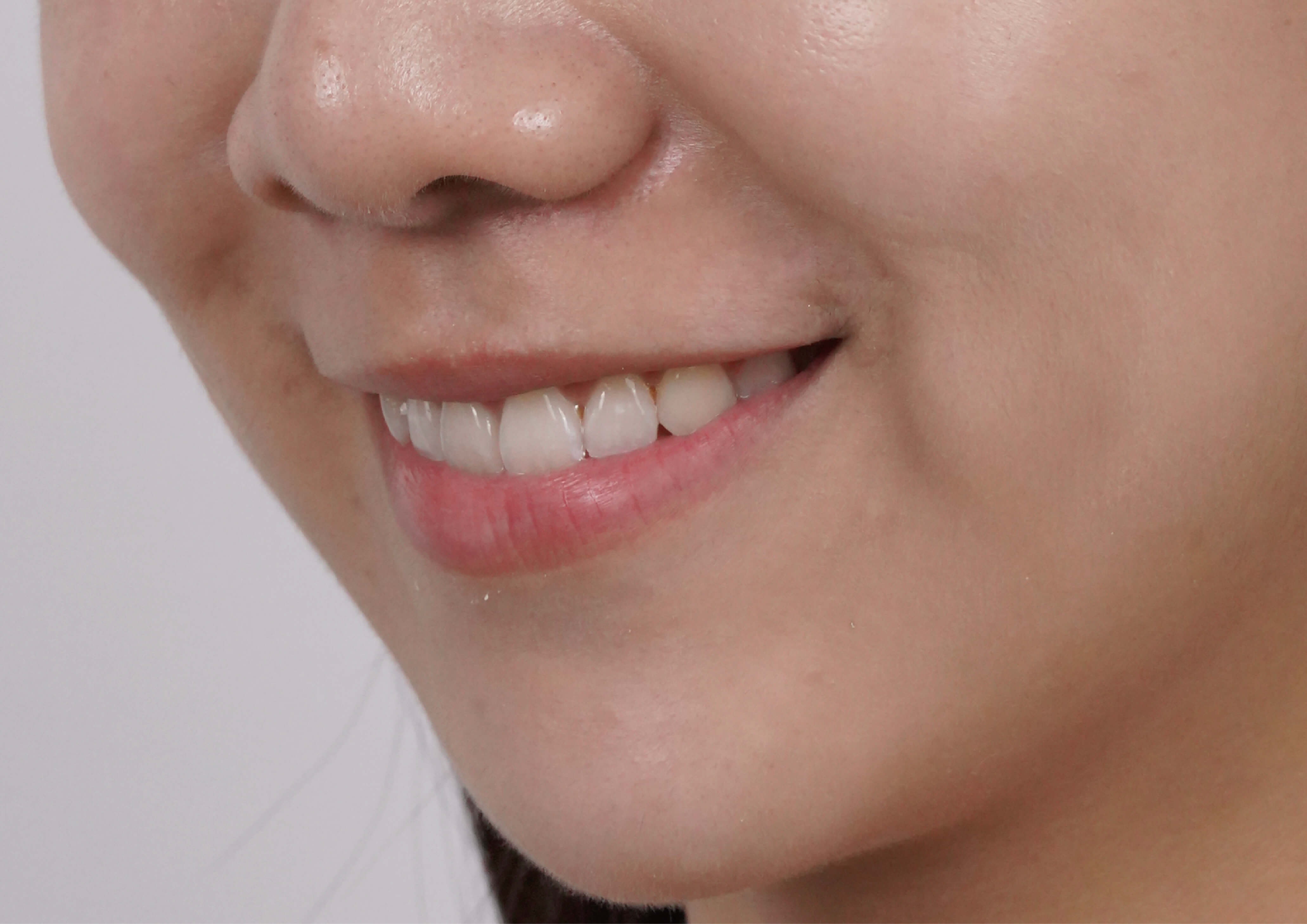 玩美笑容是我的敬業態度!