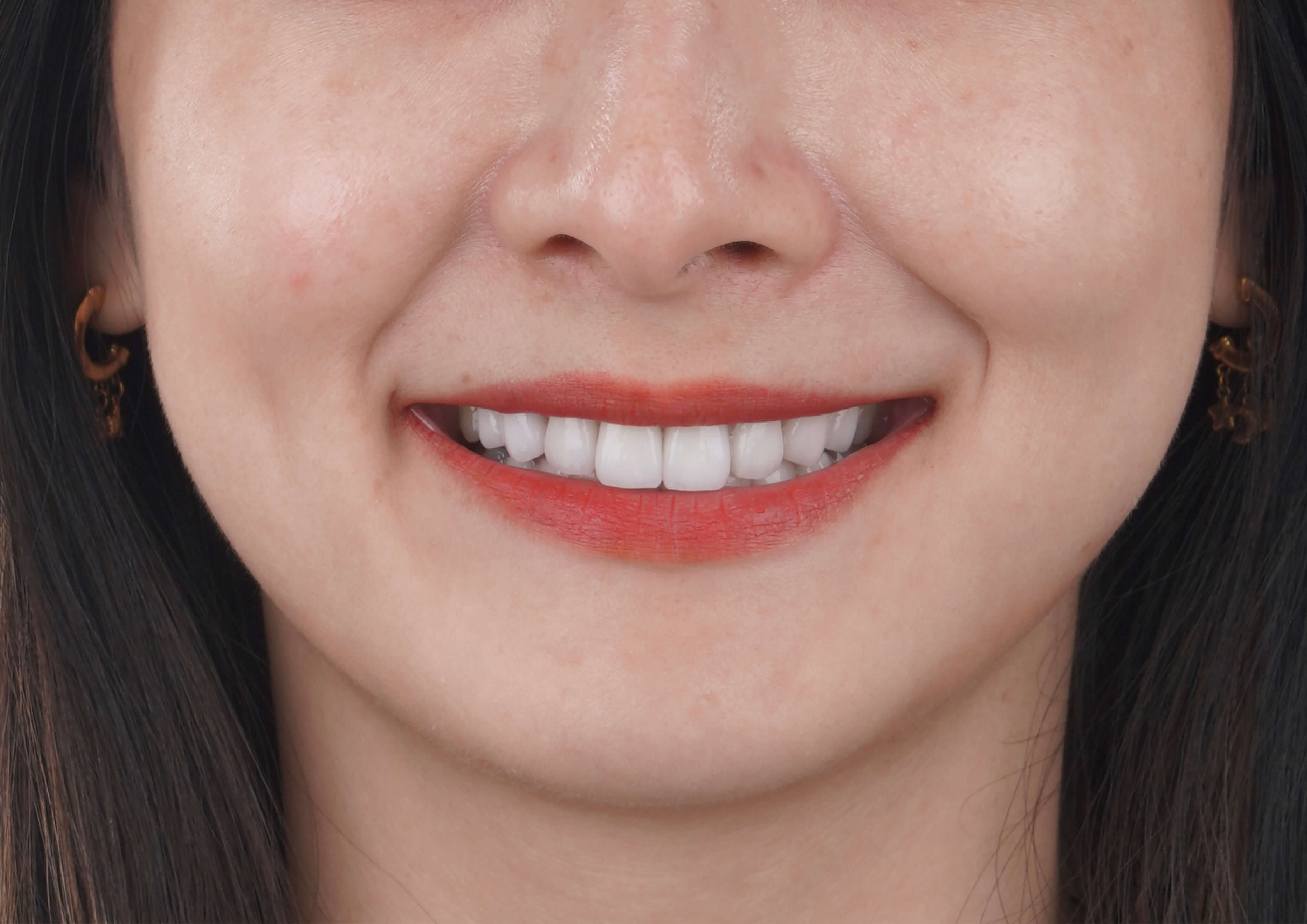 秀美與阿福│時尚夫婦 ~ 玩美微笑密技