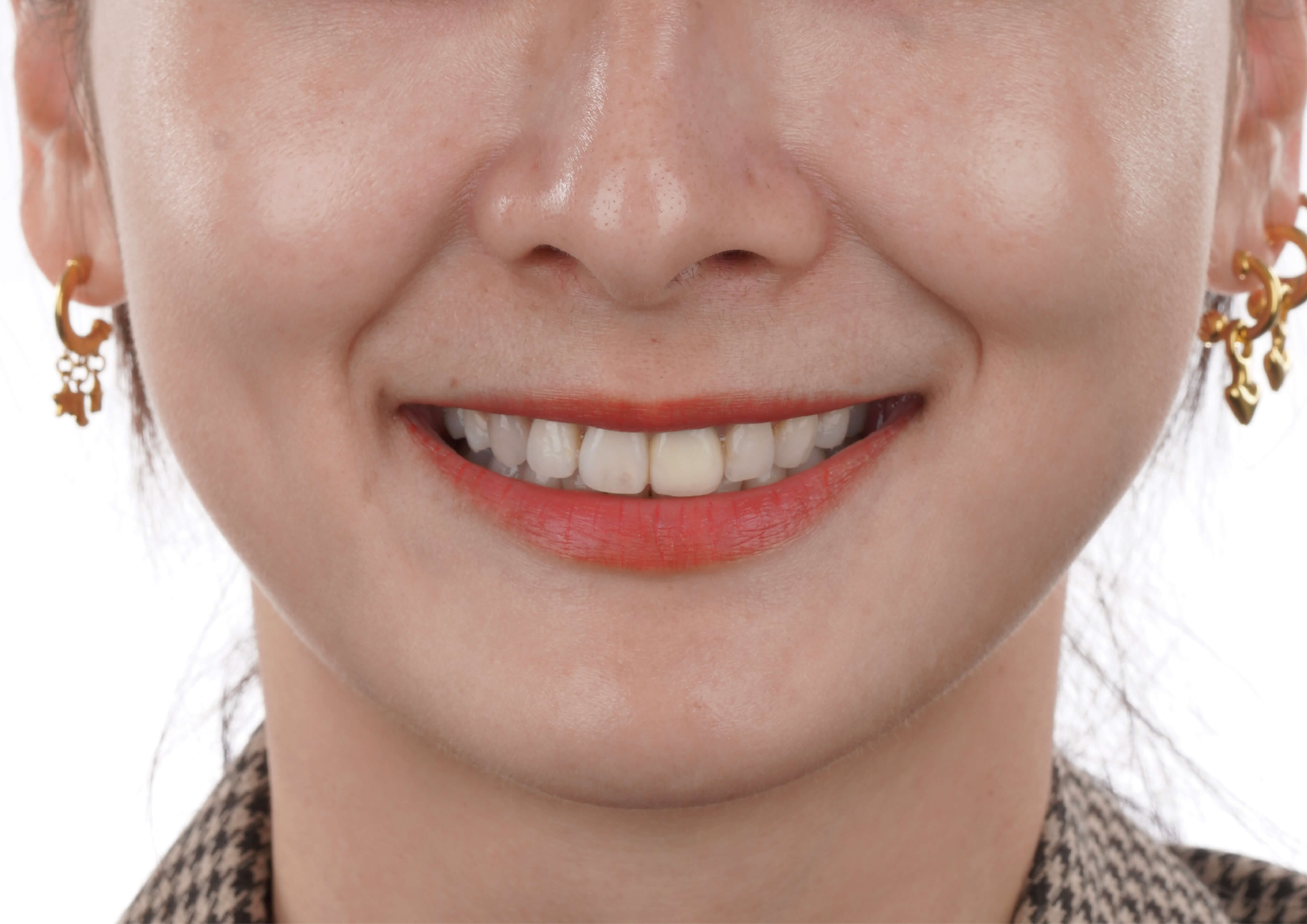 秀美與阿福│時尚夫婦 ~ 玩美微笑密技