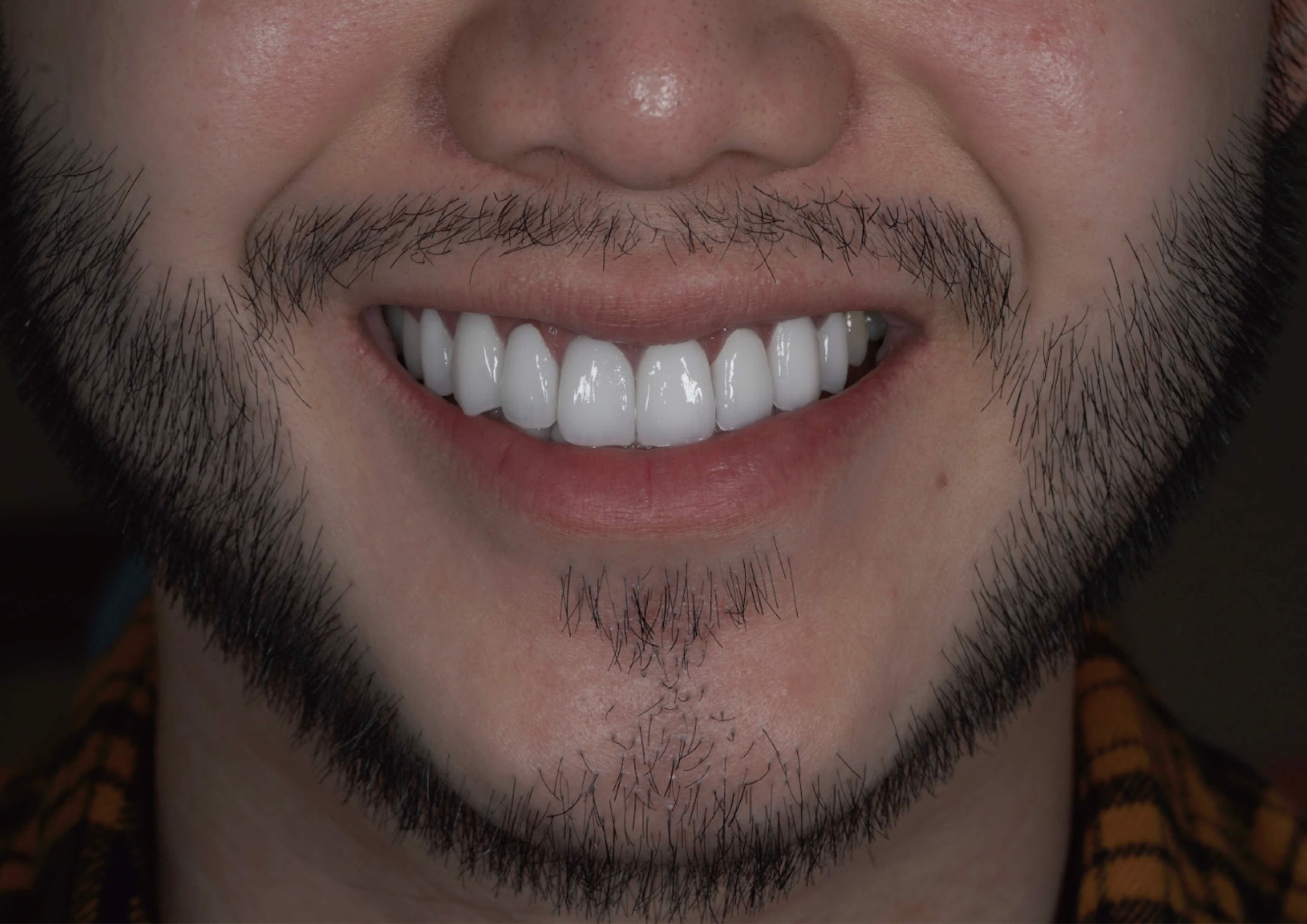 型男的時尚的指標~用微笑定義你的魅力!