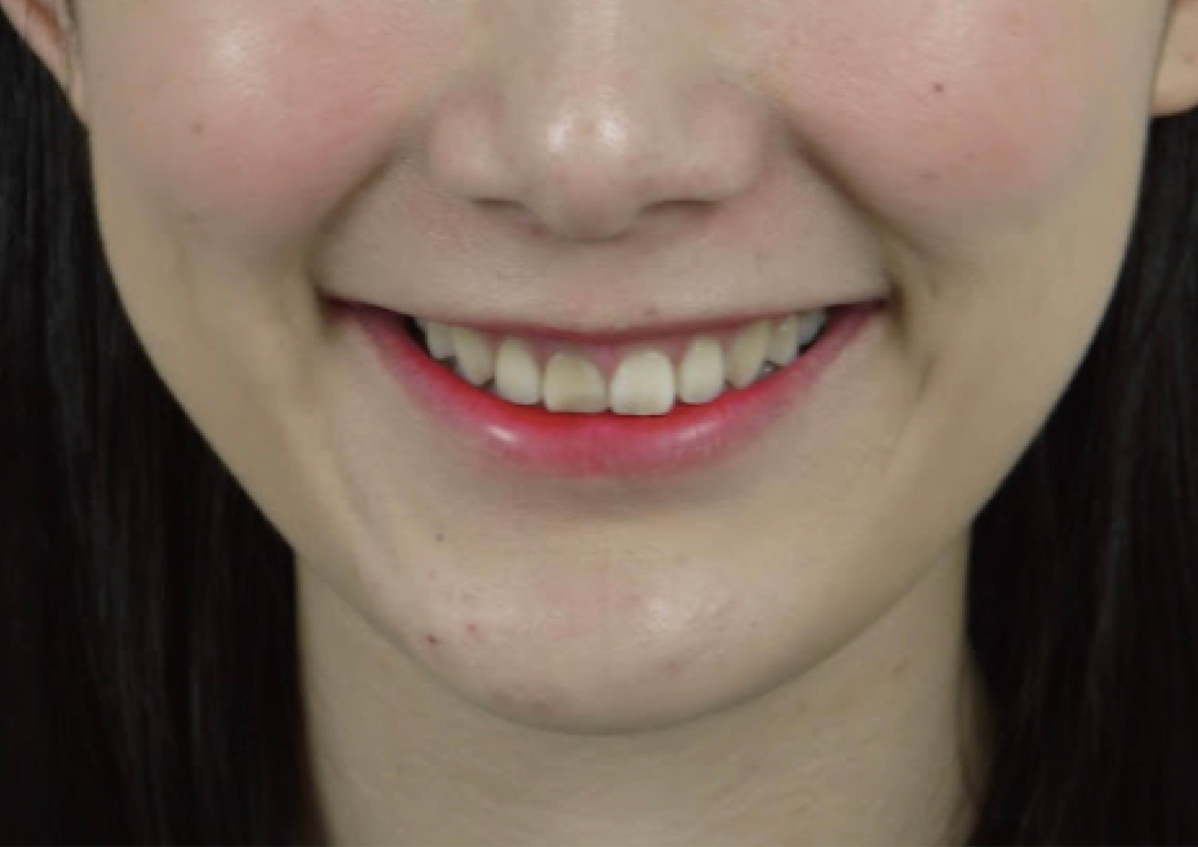 我是MIDA~愛上我的玩美微笑