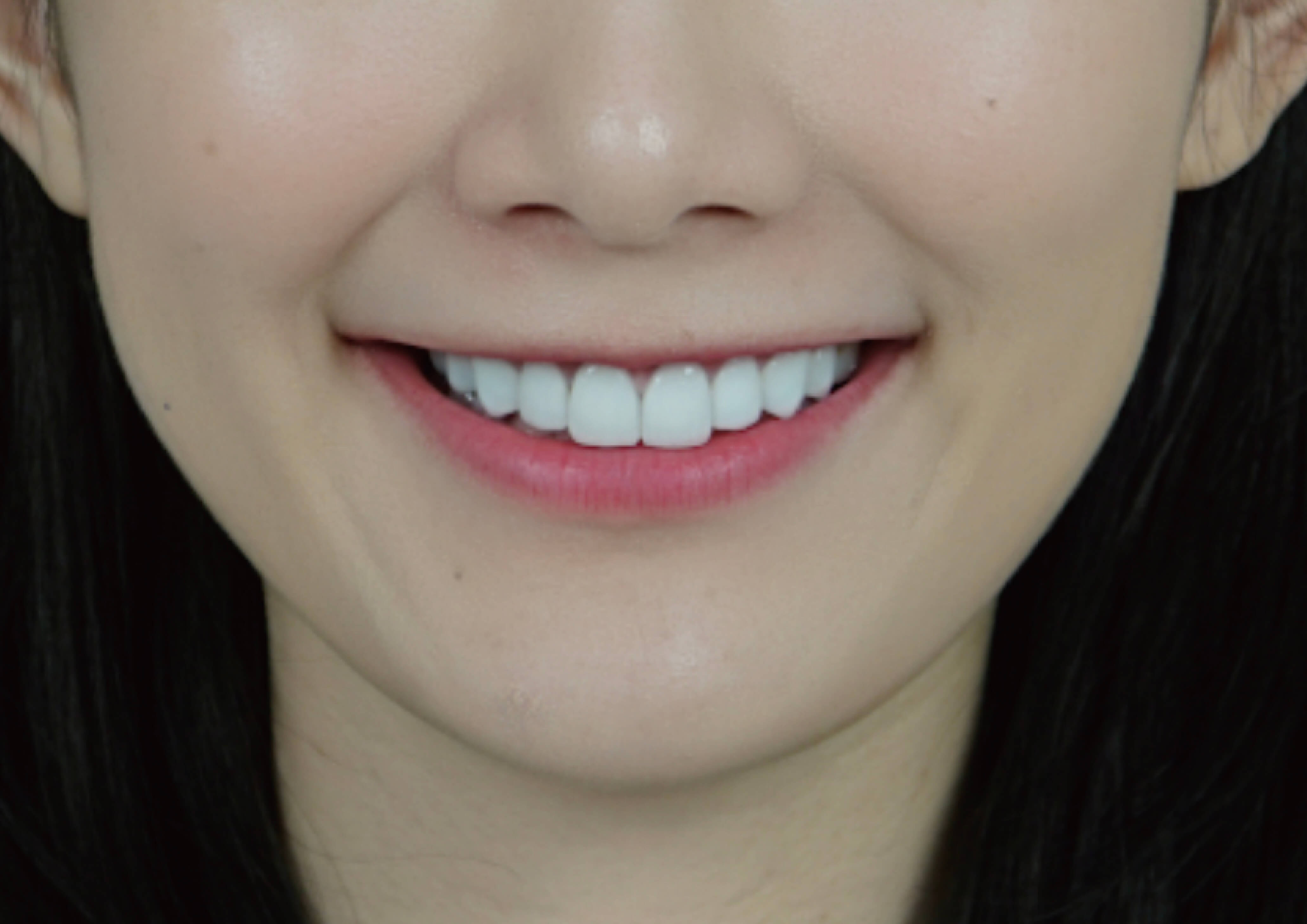 我是MIDA~愛上我的玩美微笑