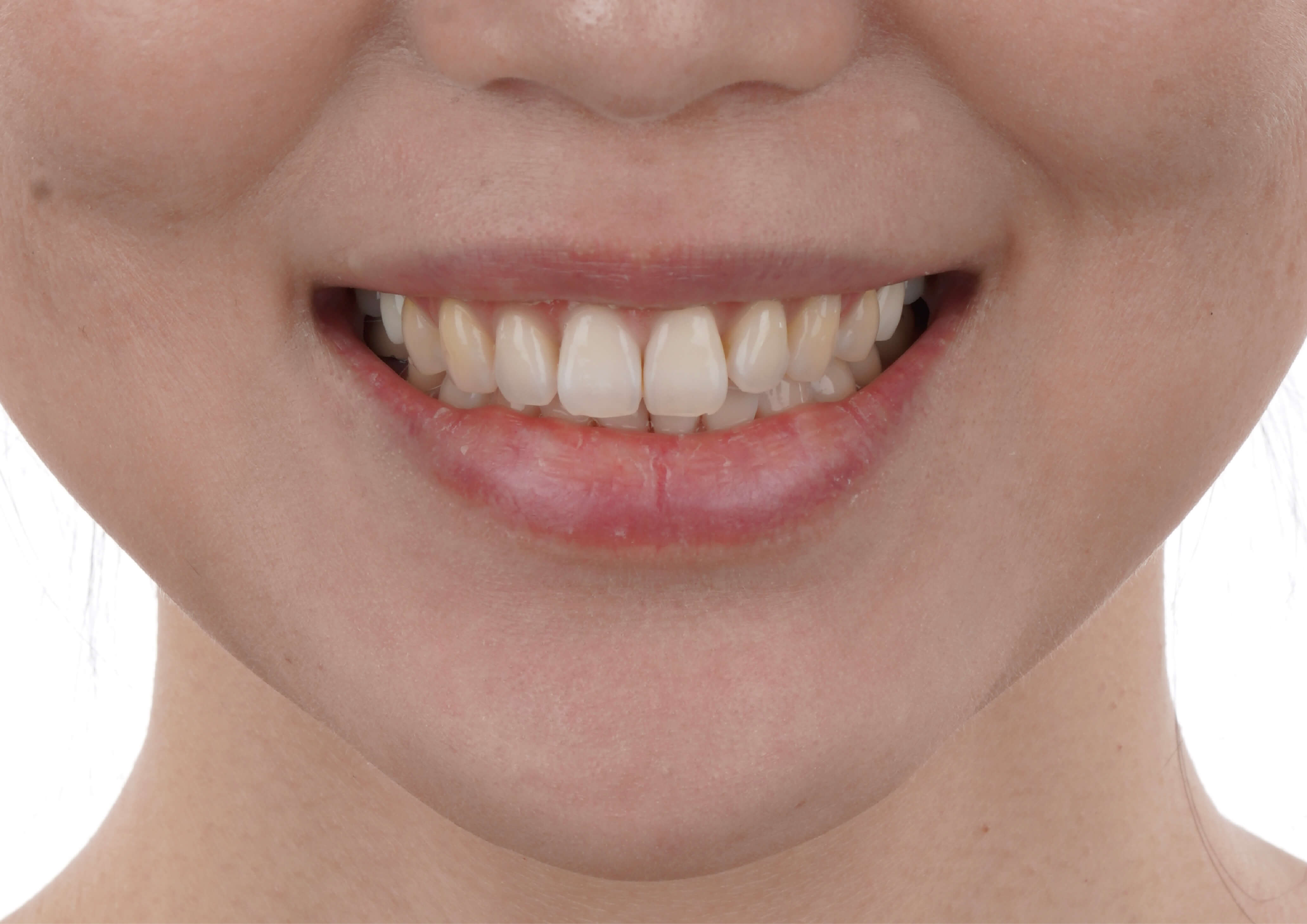 玩美微笑成就完美的自己