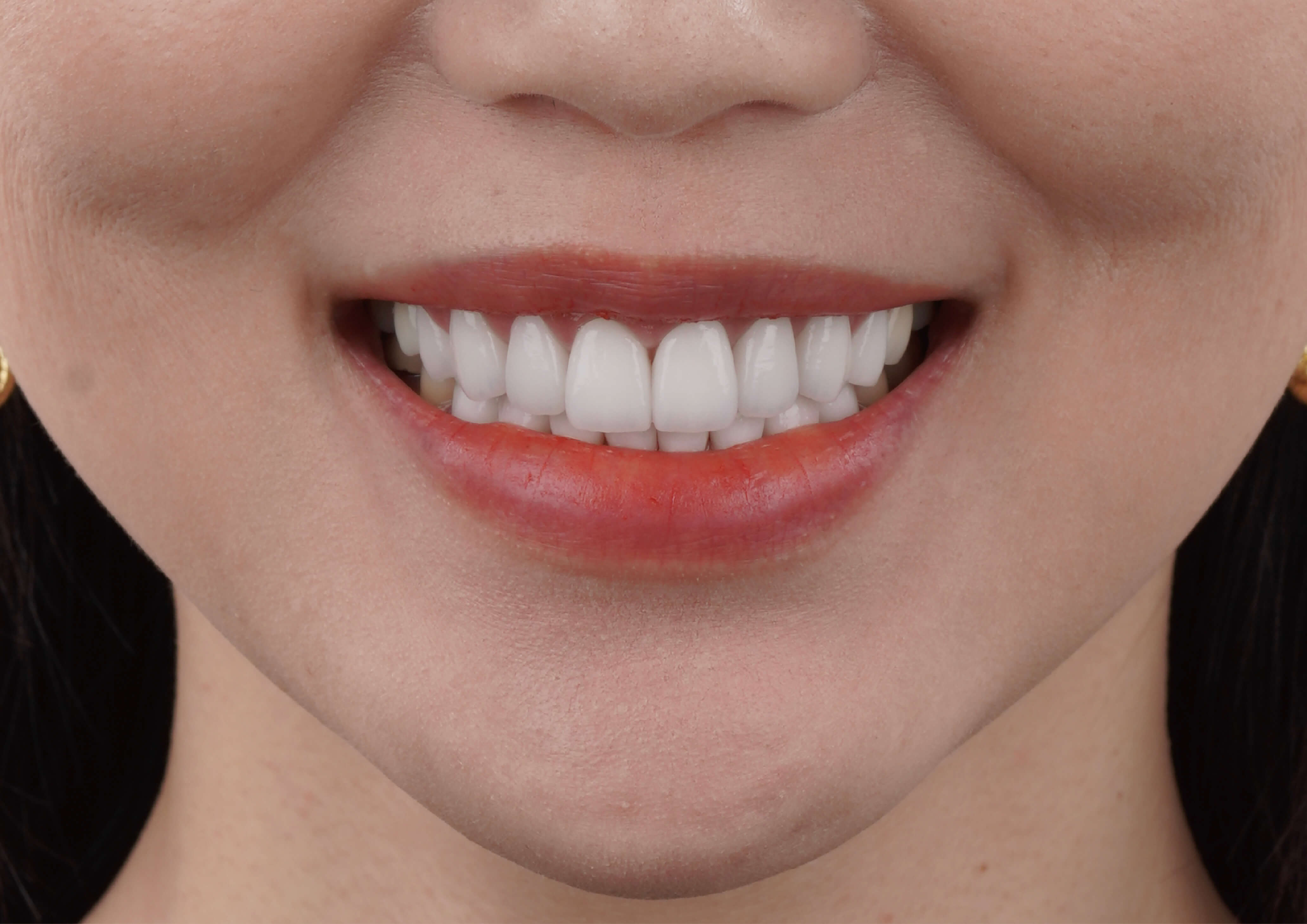 玩美微笑成就完美的自己