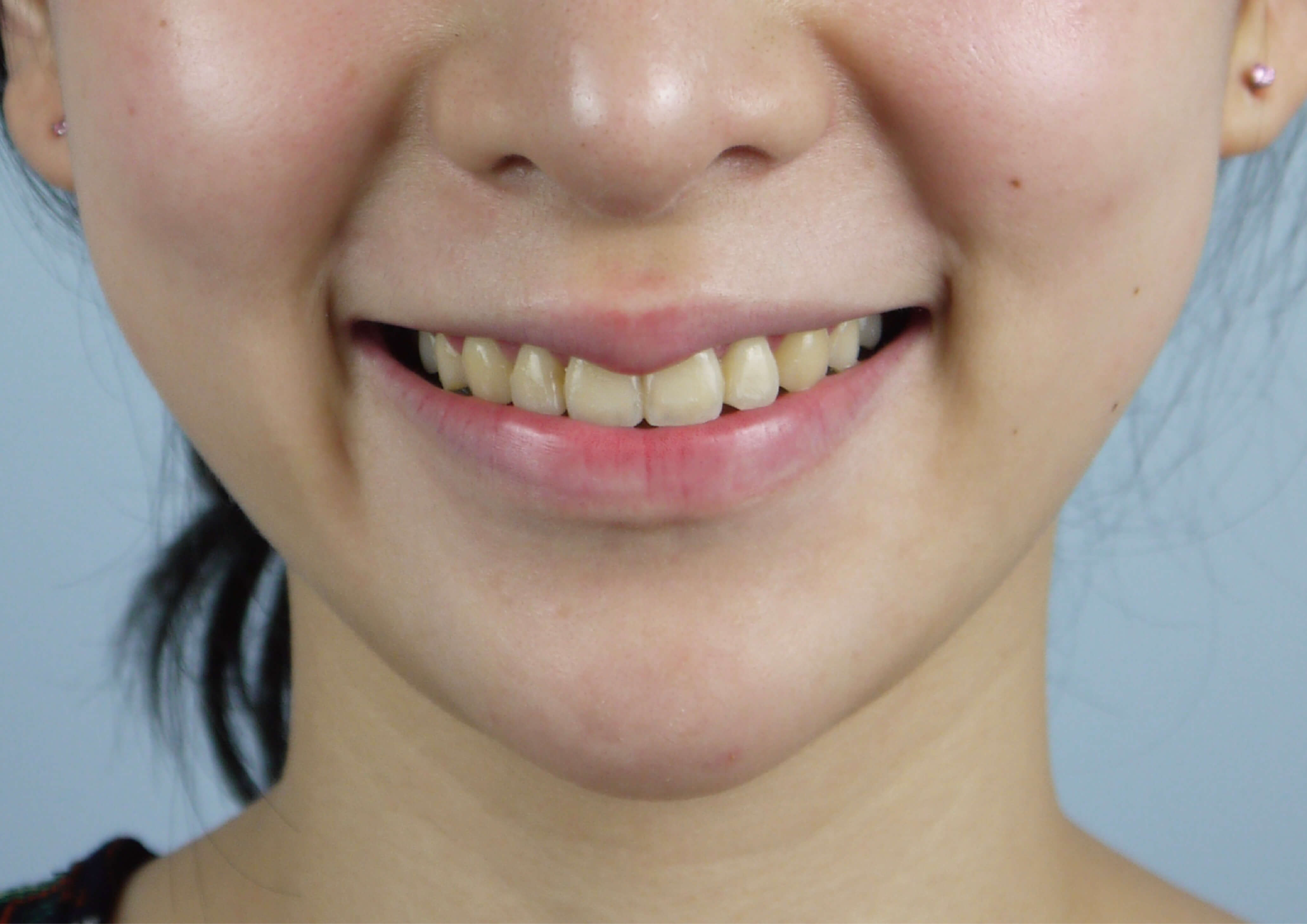 玩美微笑森呼吸 /NaiNai