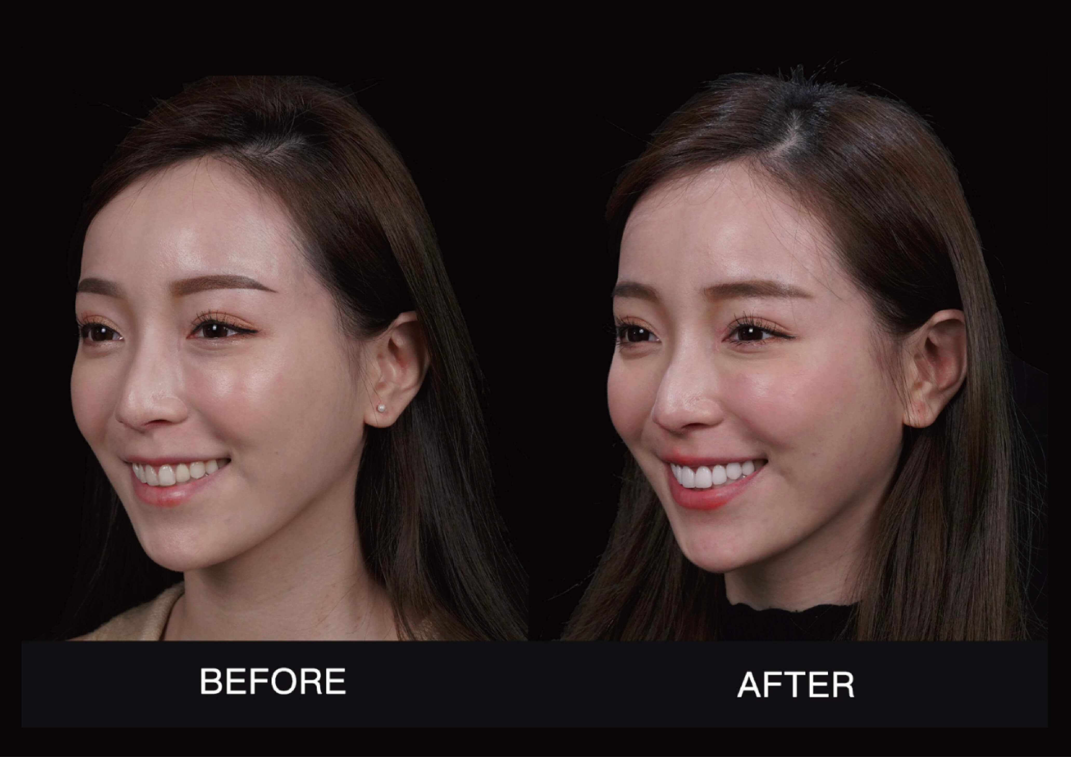 未命名-7_工作區域 1